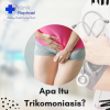 trikomoniasis
