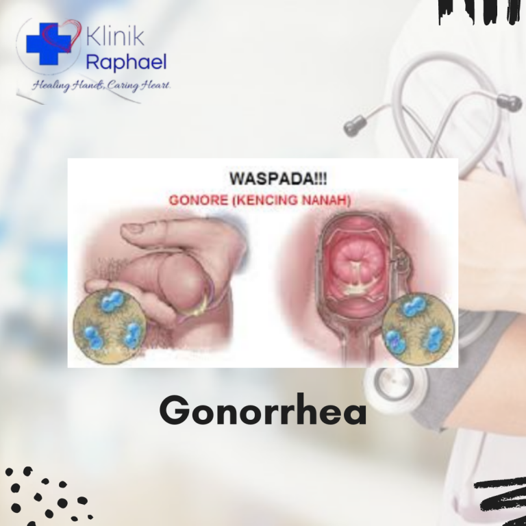 gejala gonore pada pria