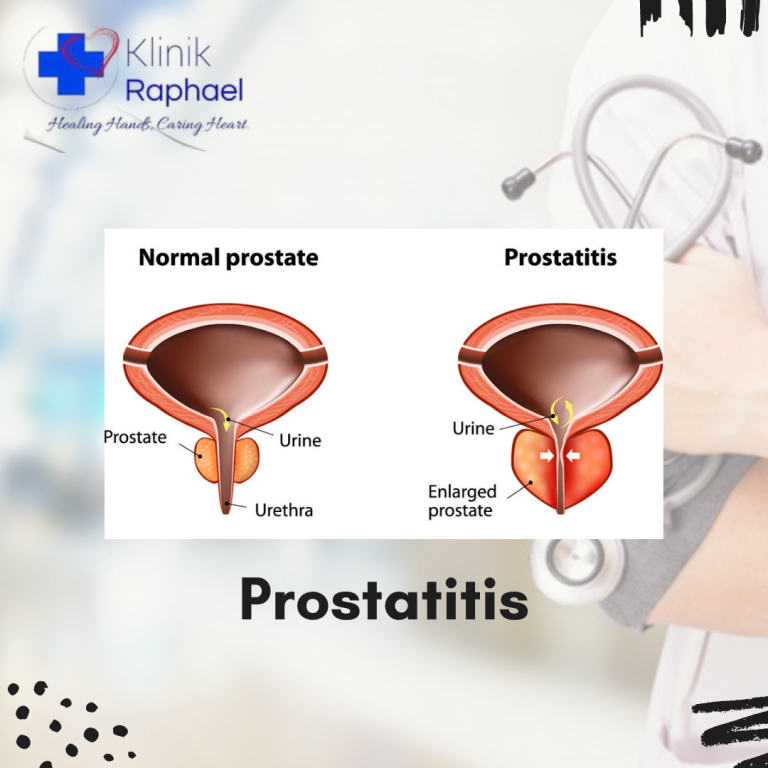 prostatitis