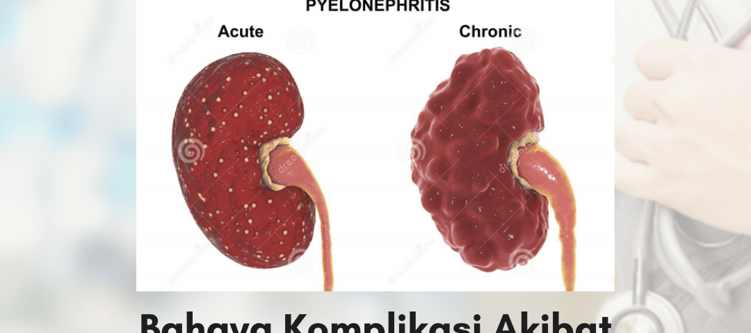 pielonefritis