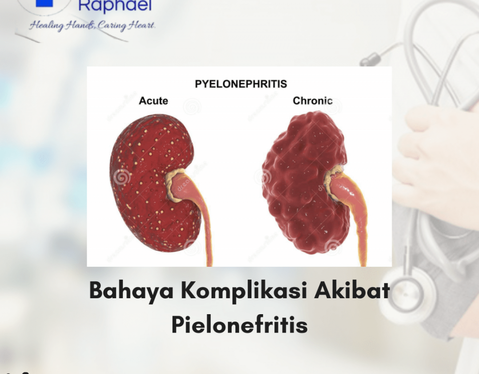 pielonefritis