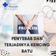 kencing batu
