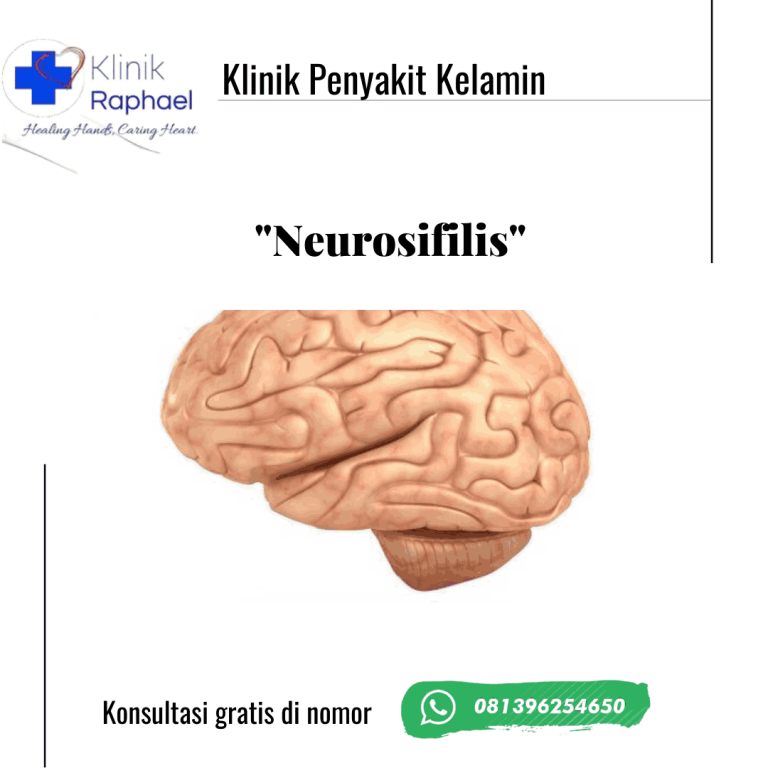 neurosifilis-komplikasi-penyakit-sifilis-atau-raja-singa
