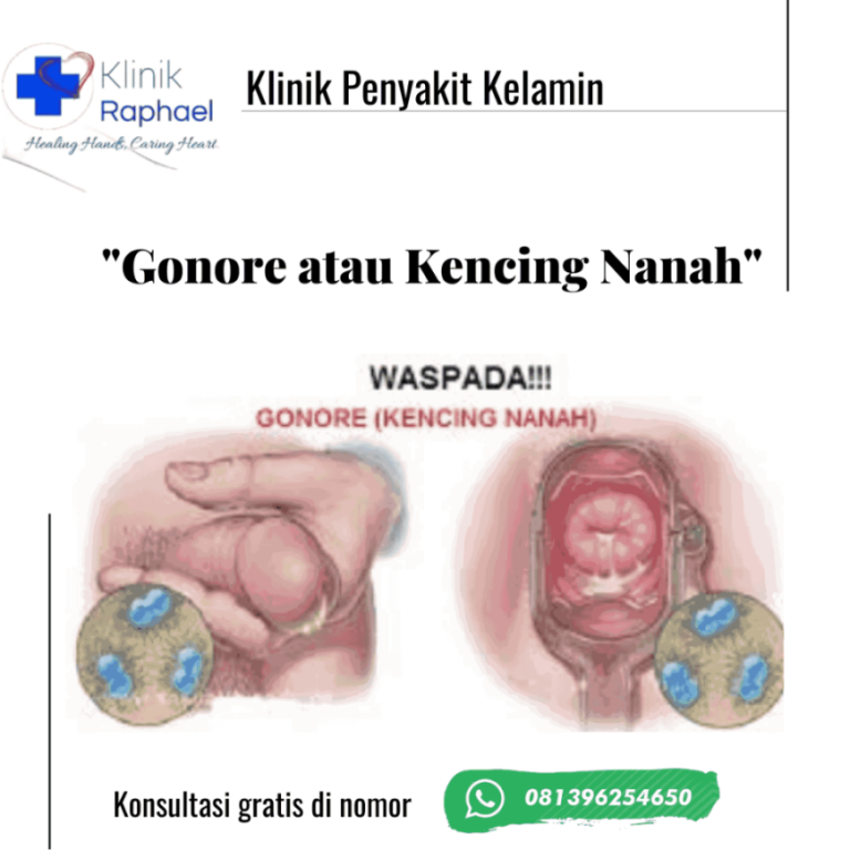 pengobatan-kencing-nanah-di-bekasi