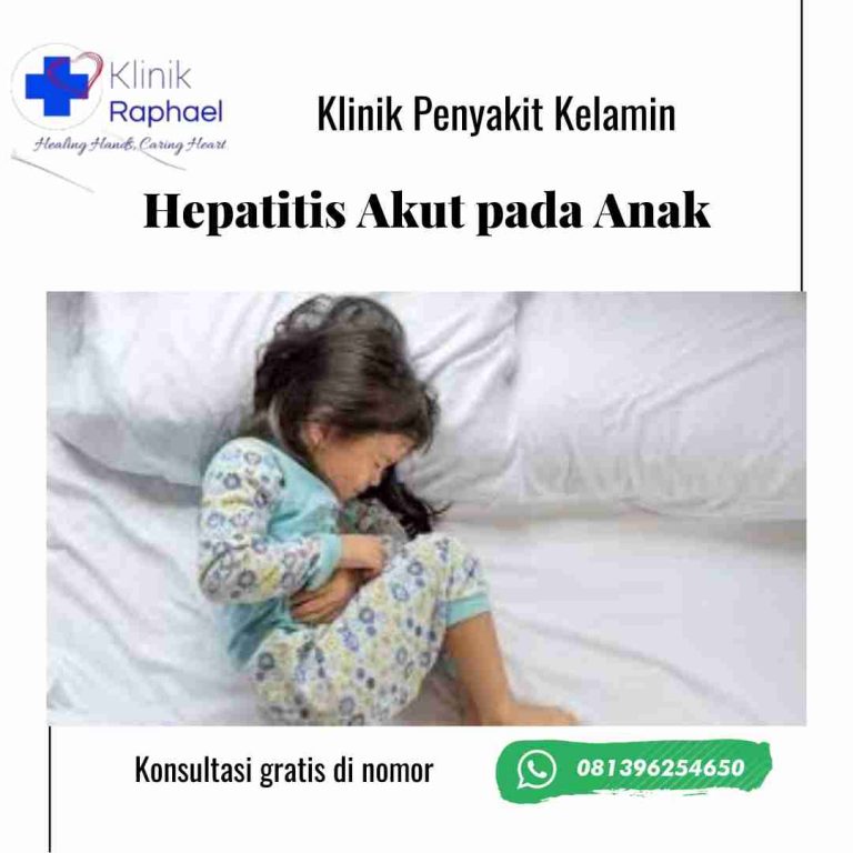 Hepatitis-akut-pada-anak