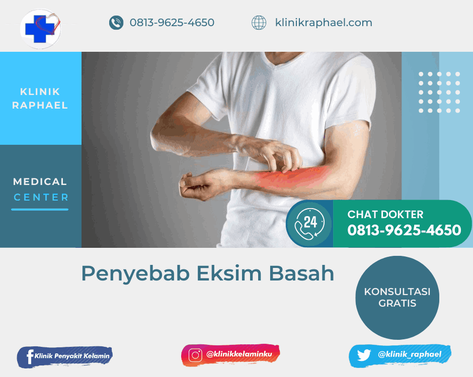 Eksim Basah