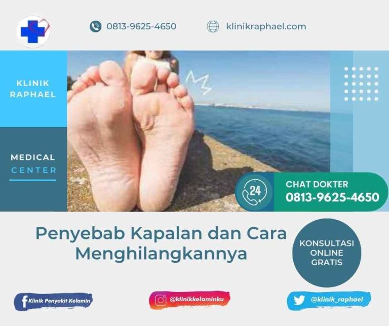 penyebab kapalan di kaki