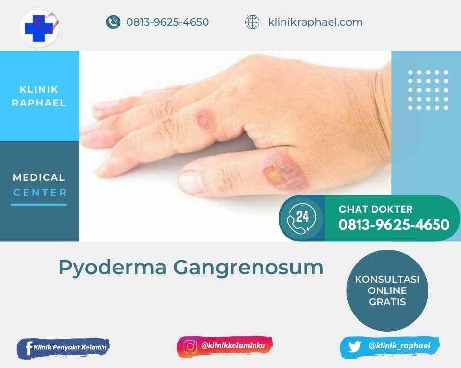 Penanganan Eksim Kering di Rumah | Klinik Raphael