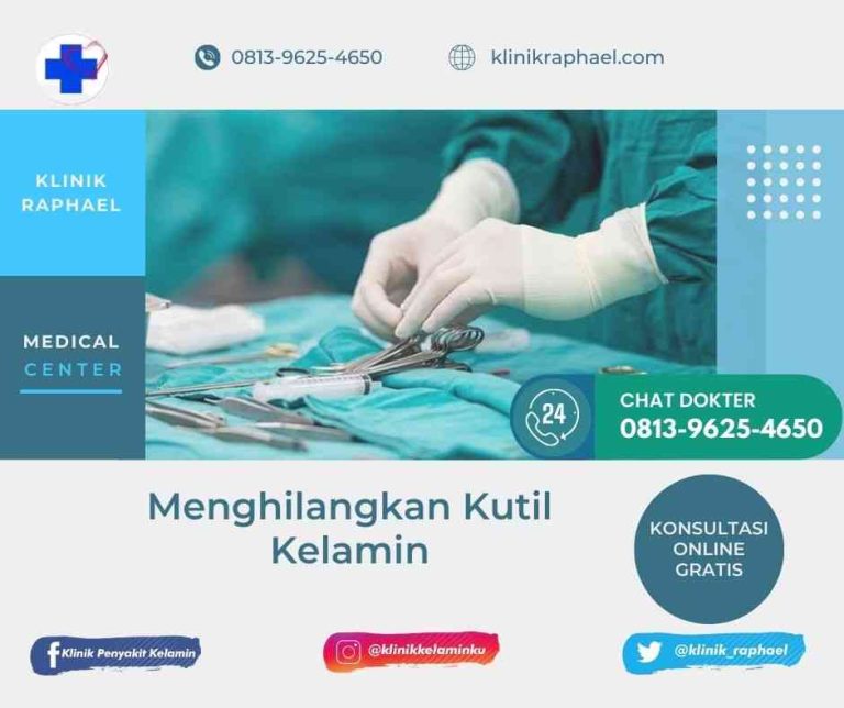 menghilangkan kutil di miss v