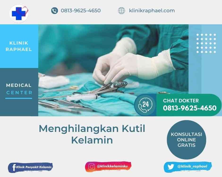 menghilangkan kutil di miss v