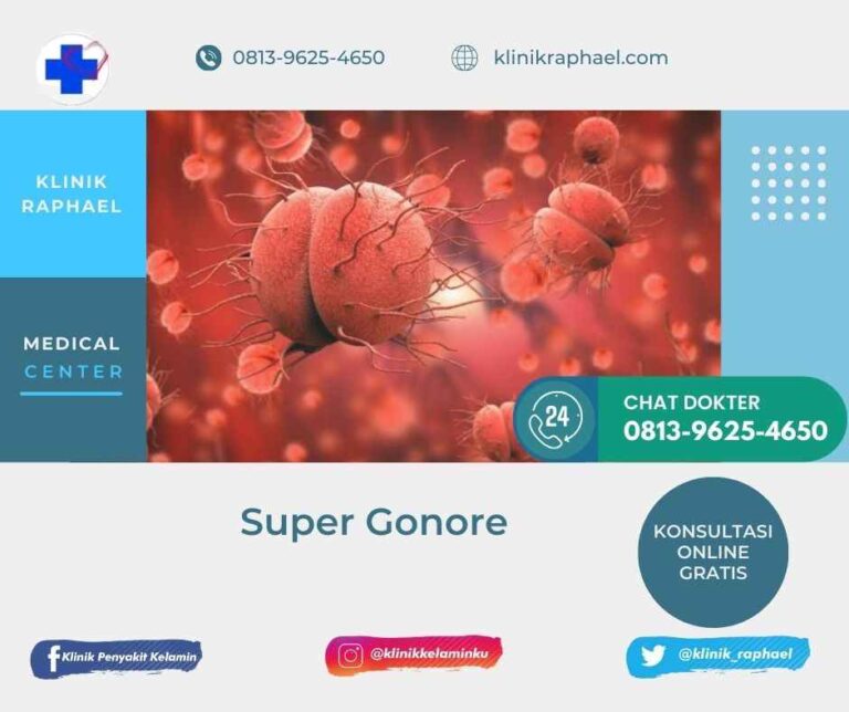 infeksi super gonore