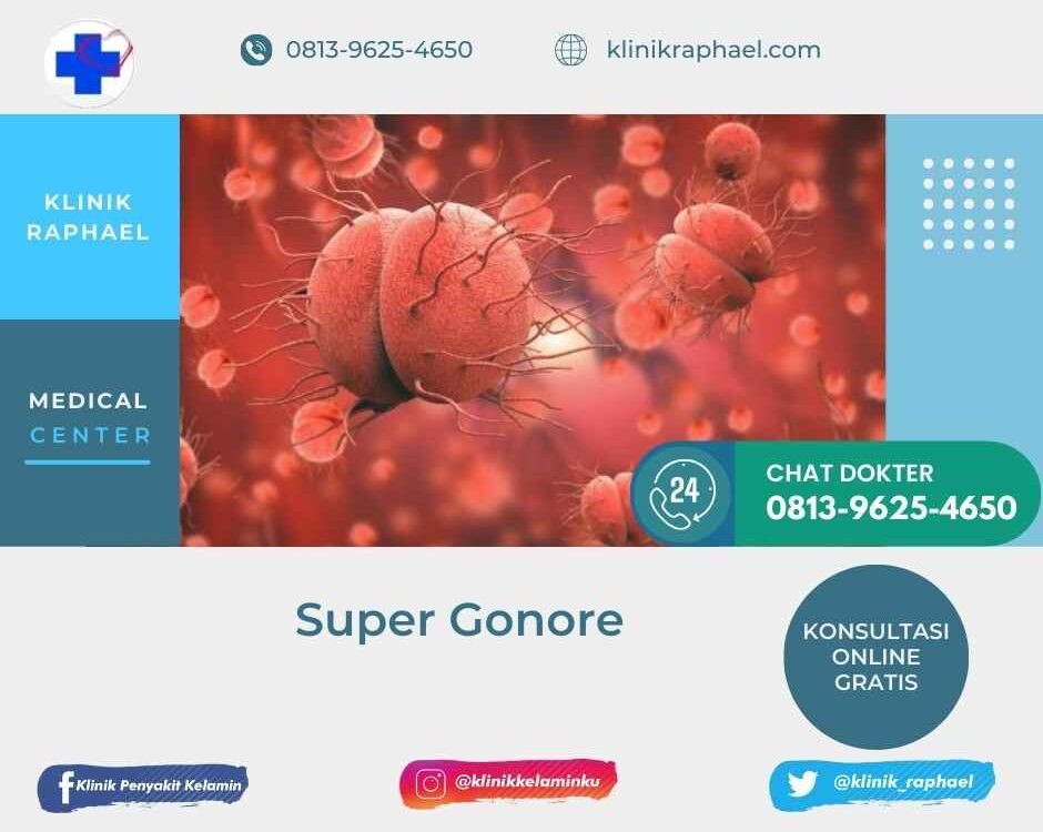 infeksi super gonore