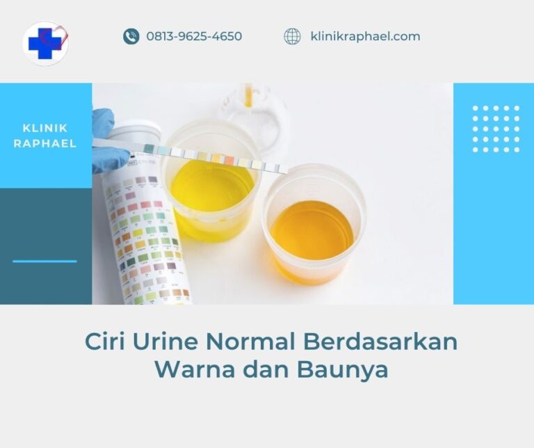 ciri urine sehat berdasarakan warna dan baunya