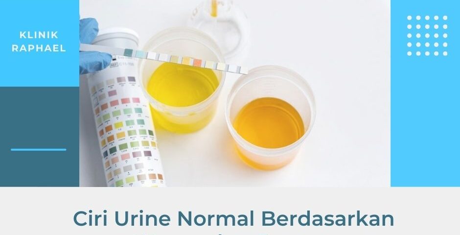 ciri urine sehat berdasarakan warna dan baunya