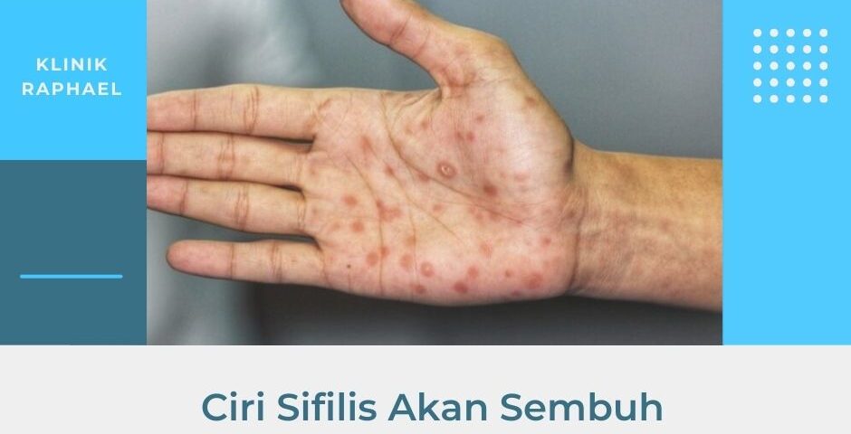ciri sifilis akan sembuh