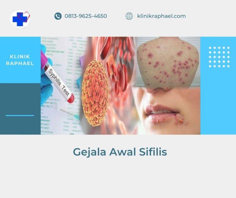 gejala sifilis pada pria