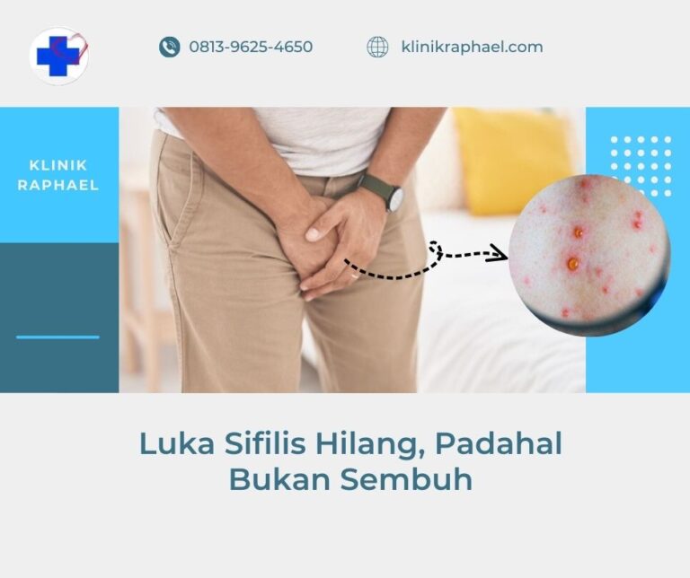 luka sifilis hilang tanpa pengobatan