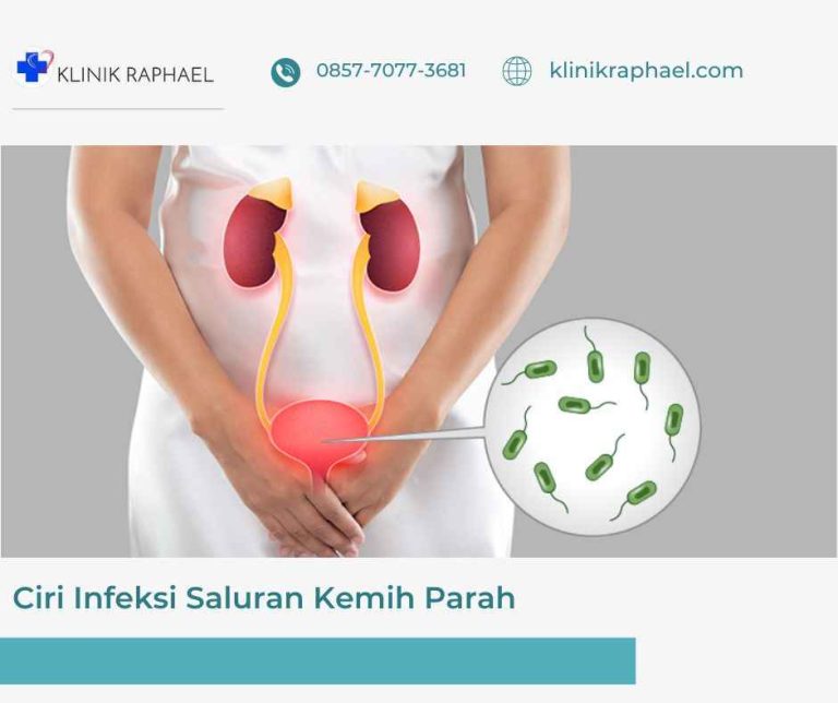 ciri infeksi saluran kemih parah