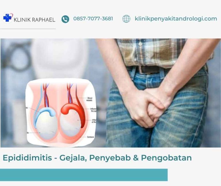 epididimitis-gejala