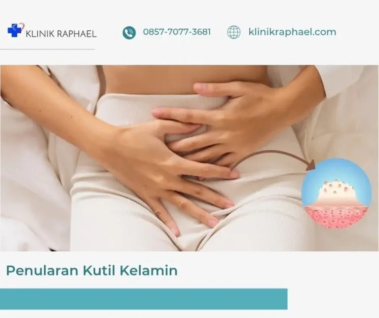 penularan-kutil-kelamin