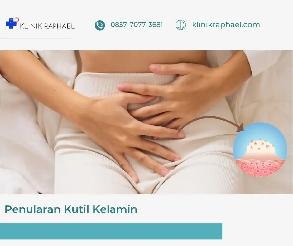 penularan-kutil-kelamin