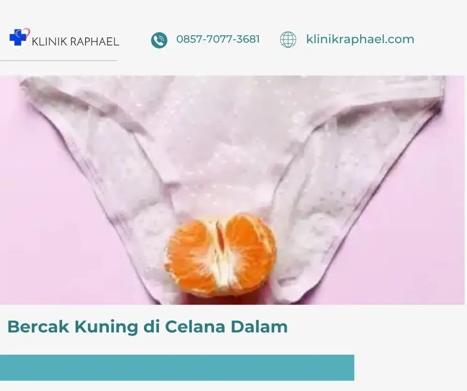bercak-kuning-di-celana-dalam
