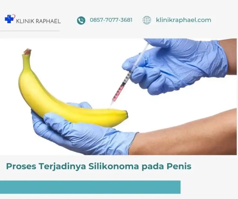 silikonoma-pada-penis